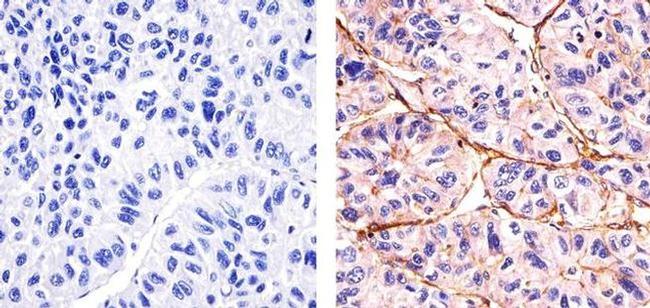 Phospho-SGK1 (Thr256) Antibody in Immunohistochemistry (Paraffin) (IHC (P))