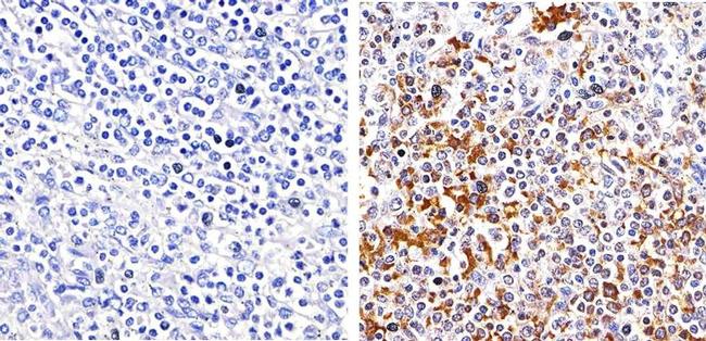 Phospho-Btk (Tyr551) Antibody in Immunohistochemistry (Paraffin) (IHC (P))