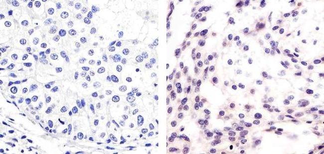 Phospho-MDM2 (Ser166) Antibody in Immunohistochemistry (Paraffin) (IHC (P))