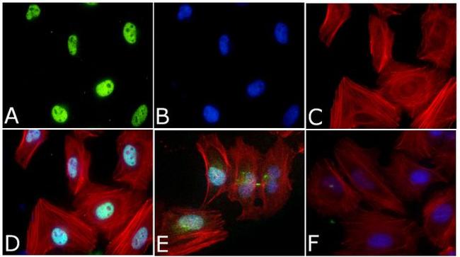 Phospho-SMAD2 (Ser465, Ser467) Antibody in Immunocytochemistry (ICC/IF)