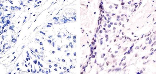 Phospho-ATF2 (Thr71) Antibody in Immunohistochemistry (Paraffin) (IHC (P))