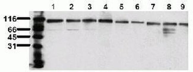 TOP1 Antibody in Western Blot (WB)