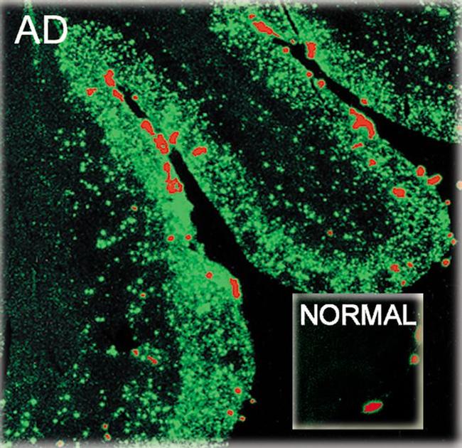 beta Amyloid (1-40) Antibody in Immunohistochemistry (IHC)