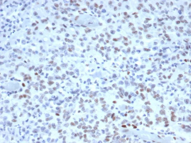 MSH2 (DNA Mismatch Repair Marker) Antibody in Immunohistochemistry (Paraffin) (IHC (P))