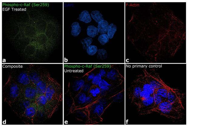 Phospho-c-Raf (Ser259) Antibody in Immunocytochemistry (ICC/IF)