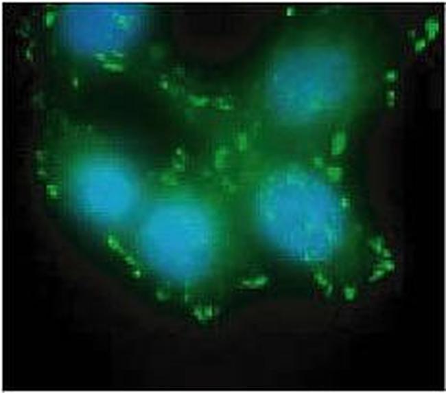 Phospho-FAK (Tyr397) Antibody in Immunocytochemistry (ICC/IF)