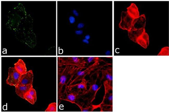 Phospho-FAK (Tyr861) Antibody in Immunocytochemistry (ICC/IF)