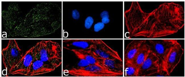 Phospho-PYK2 (Tyr579, Tyr580) Antibody in Immunocytochemistry (ICC/IF)