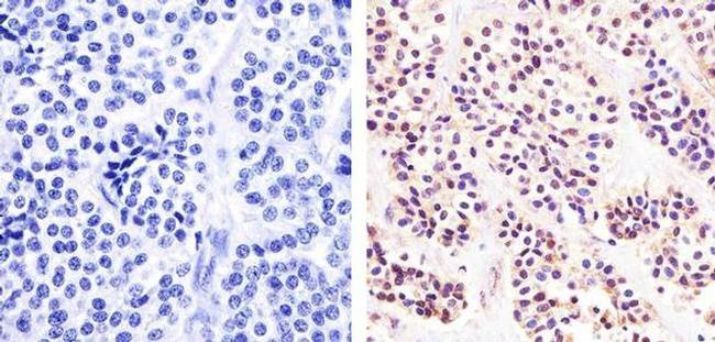 Phospho-p53 (Ser392) Antibody in Immunohistochemistry (Paraffin) (IHC (P))