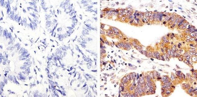 Phospho-SRC (Tyr419) Antibody in Immunohistochemistry (Paraffin) (IHC (P))