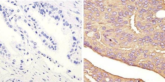 JNK1 Antibody in Immunohistochemistry (Paraffin) (IHC (P))