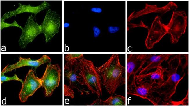 Phospho-IKK alpha (Ser176, Ser180) Antibody in Immunocytochemistry (ICC/IF)