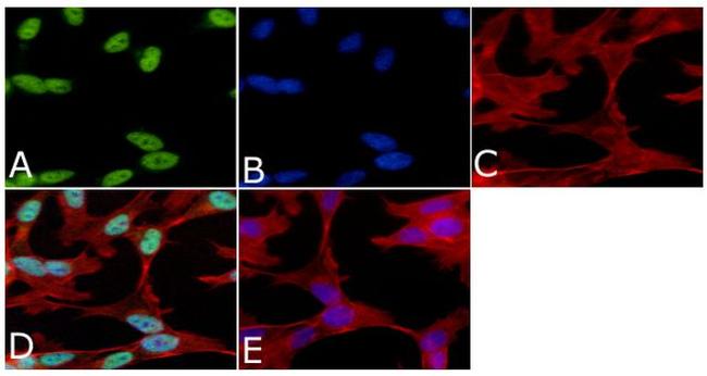 Phospho-Tau (Ser199) Antibody in Immunocytochemistry (ICC/IF)