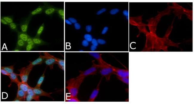 Phospho-Tau (Thr205) Antibody in Immunocytochemistry (ICC/IF)