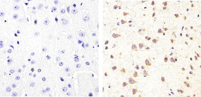 Phospho-Tau (Ser409) Antibody in Immunohistochemistry (Paraffin) (IHC (P))