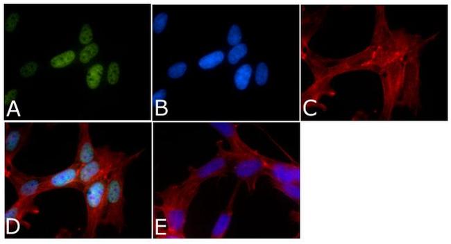 Phospho-Tau (Ser199, Ser202) Antibody in Immunocytochemistry (ICC/IF)