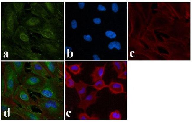 Phospho-EGFR (Tyr1148) Antibody in Immunocytochemistry (ICC/IF)