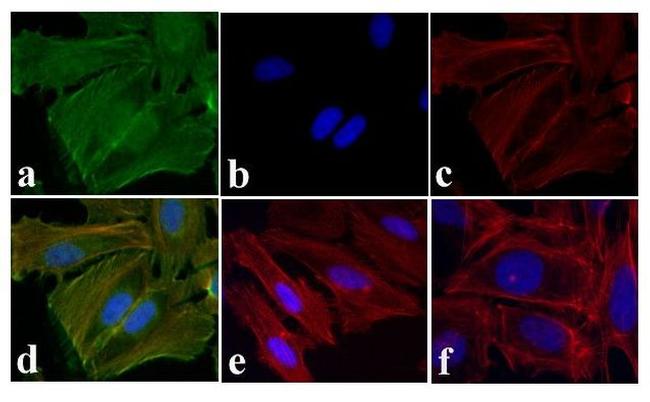 Phospho-EGFR (Tyr1173) Antibody in Immunocytochemistry (ICC/IF)