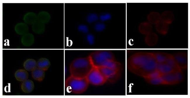 Phospho-IR/IGF1R (Tyr1158) Antibody in Immunocytochemistry (ICC/IF)