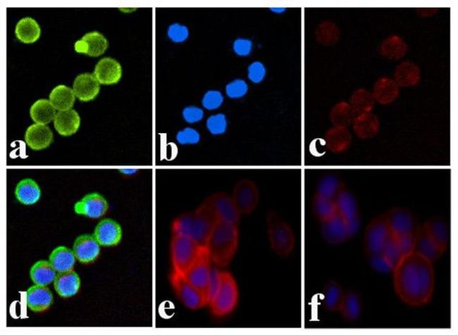 Phospho-INSR (Tyr1334) Antibody in Immunocytochemistry (ICC/IF)