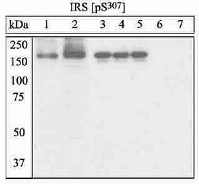 Phospho-IRS1 (Ser307) Antibody in Western Blot (WB)