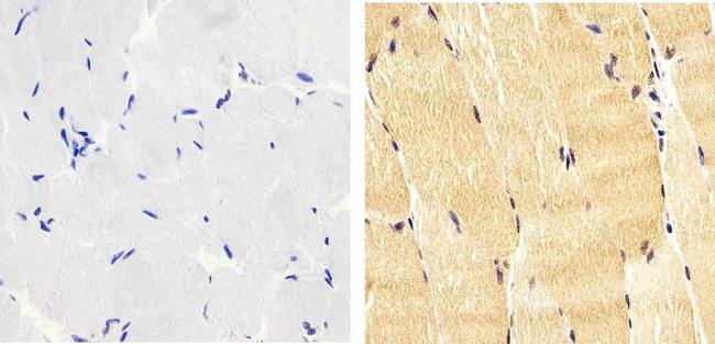 Phospho-IRS1 (Tyr612) Antibody in Immunohistochemistry (Paraffin) (IHC (P))