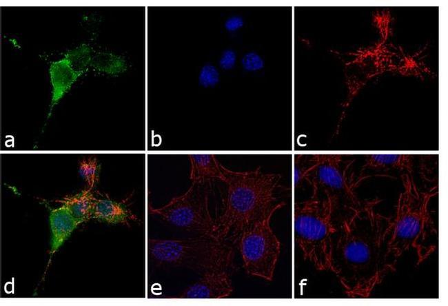 Phospho-Cortactin (Tyr421) Antibody in Immunocytochemistry (ICC/IF)