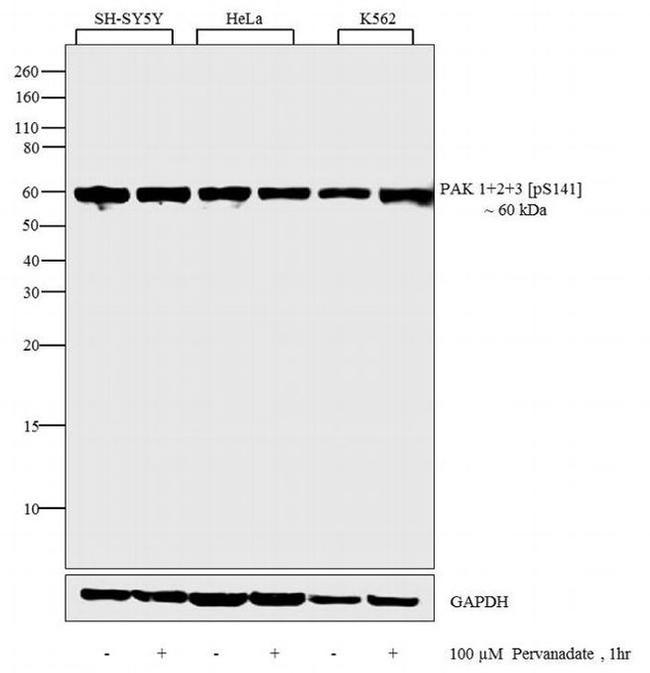 Phospho-PAK1/2/3 (Ser141) Antibody in Western Blot (WB)