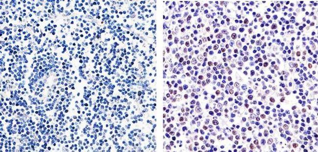 Phospho-GATA4 (Ser105) Antibody in Immunohistochemistry (Paraffin) (IHC (P))