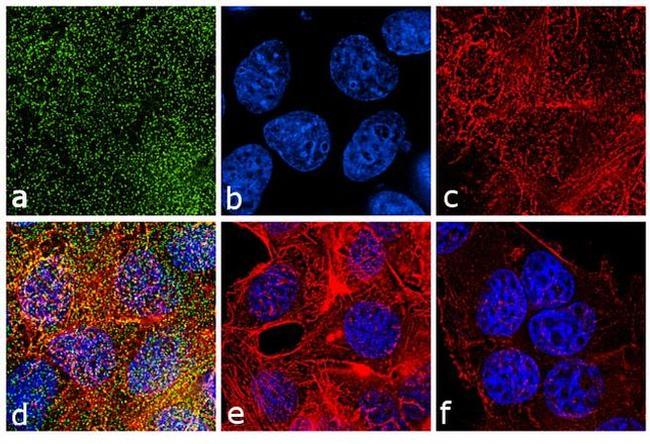 Phospho-PKC alpha (Thr638) Antibody in Immunocytochemistry (ICC/IF)