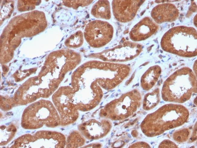 MTAP Antibody in Immunohistochemistry (Paraffin) (IHC (P))