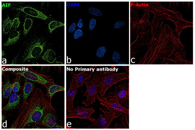 AIF Antibody in Immunocytochemistry (ICC/IF)