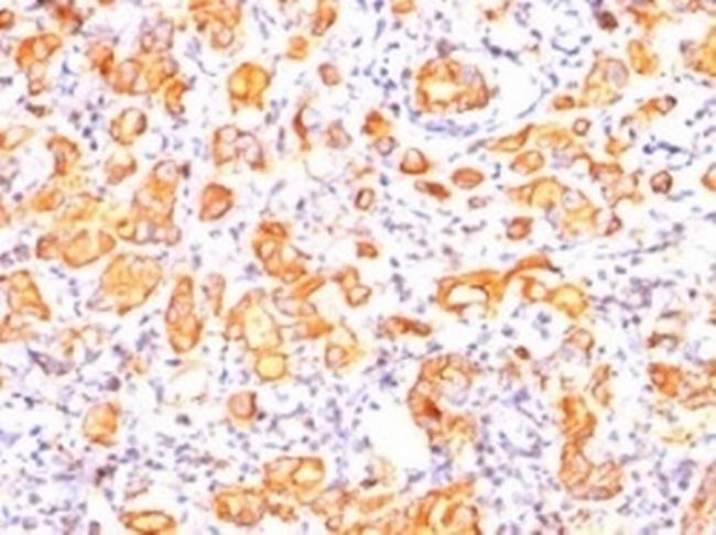 MUC1/CA15-3/EMA/CD227 (Epithelial Marker) Antibody in Immunohistochemistry (Paraffin) (IHC (P))