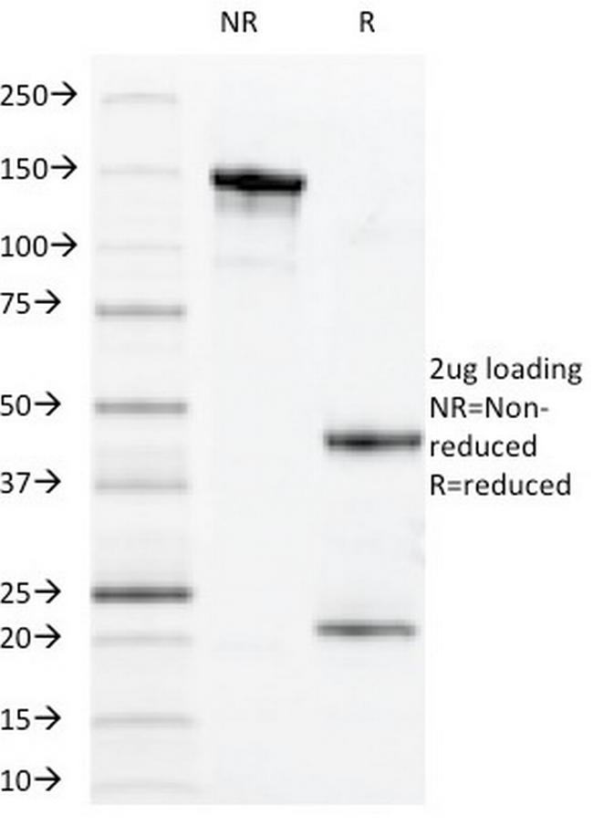 MUC1/CA15-3/EMA/CD227 (Epithelial Marker) Antibody in SDS-PAGE (SDS-PAGE)