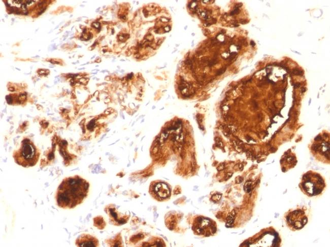 MUC1/CA15-3/EMA/CD227 Antibody in Immunohistochemistry (Paraffin) (IHC (P))