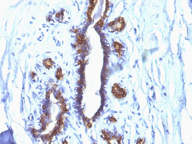 MUC1/CA15-3/EMA/CD227 (Epithelial Marker) Antibody in Immunohistochemistry (Paraffin) (IHC (P))