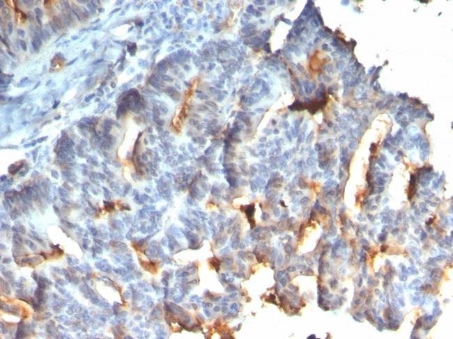 MUC1/CA15-3/EMA/CD227 Antibody in Immunohistochemistry (Paraffin) (IHC (P))