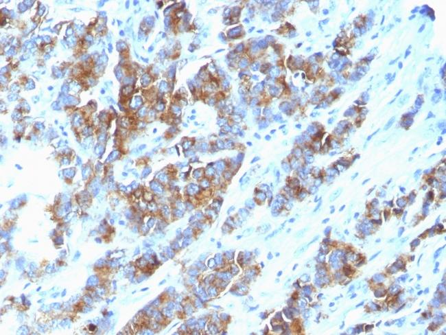 MUC1/CA15-3/EMA/CD227 (Epithelial Marker) Antibody in Immunohistochemistry (Paraffin) (IHC (P))