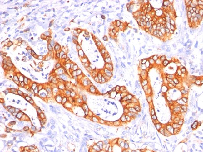 MUC1/CA15-3/EMA/CD227 (Epithelial Marker) Antibody in Immunohistochemistry (Paraffin) (IHC (P))