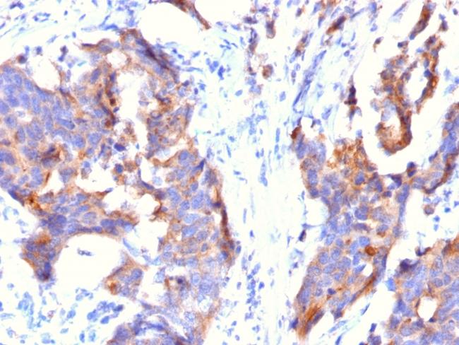 MUC1/CA15-3/EMA/CD227 (Epithelial Marker) Antibody in Immunohistochemistry (Paraffin) (IHC (P))