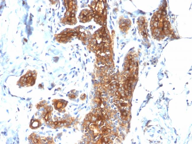 MUC1/CA15-3/EMA/CD227 (Epithelial Marker) Antibody in Immunohistochemistry (Paraffin) (IHC (P))