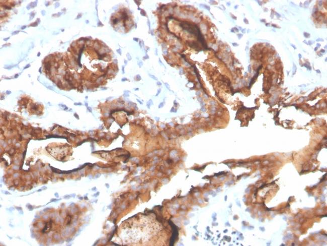 MUC1/CA15-3/EMA/CD227 (Epithelial Marker) Antibody in Immunohistochemistry (Paraffin) (IHC (P))