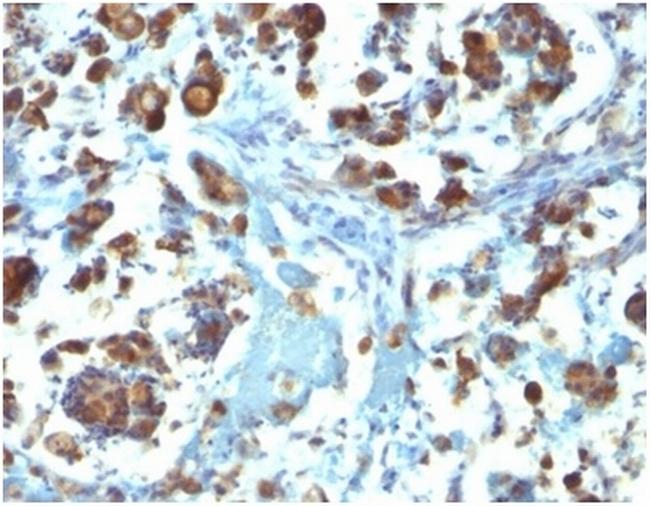 MUC3 (Mucin 3) Antibody in Immunohistochemistry (Paraffin) (IHC (P))