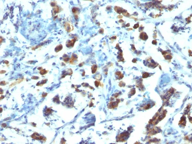 MUC3 (Mucin 3) Antibody in Immunohistochemistry (Paraffin) (IHC (P))