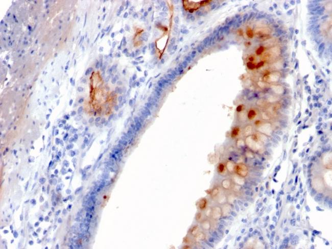 MUC4 (Mucin 4/Gastric Mucin) Antibody in Immunohistochemistry (Paraffin) (IHC (P))