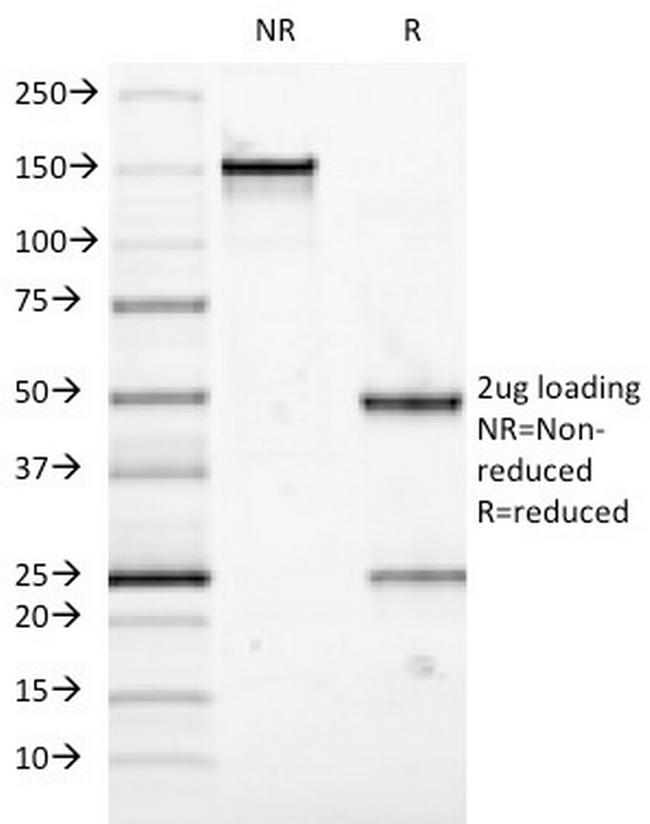 MUC5AC (Mucin 5AC/Gastric Mucin) Antibody in SDS-PAGE (SDS-PAGE)