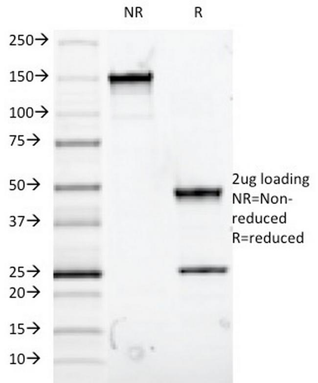 MUC5AC (Mucin 5AC/Gastric Mucin) Antibody in SDS-PAGE (SDS-PAGE)