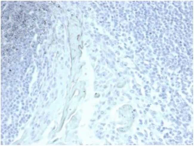 MUC5AC (Mucin 5AC/Gastric Mucin) Antibody in Immunohistochemistry (Paraffin) (IHC (P))