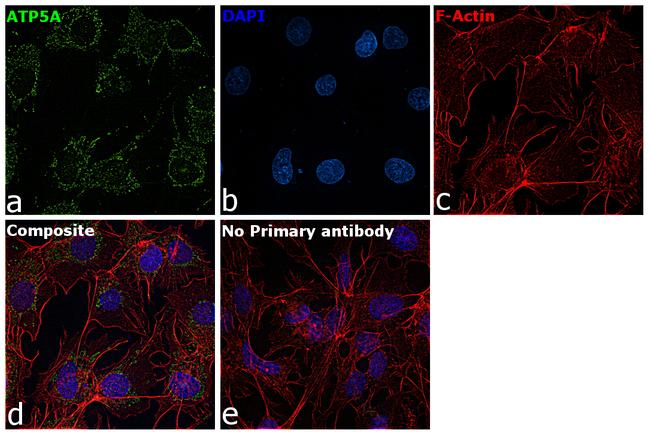 ATP5H Antibody in Immunocytochemistry (ICC/IF)