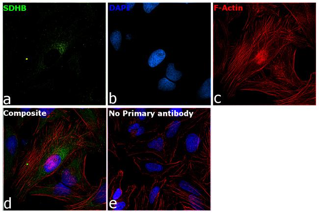 SDHB Antibody in Immunocytochemistry (ICC/IF)